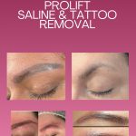 ProLift®  Permanent Makeup & Microblading Removal